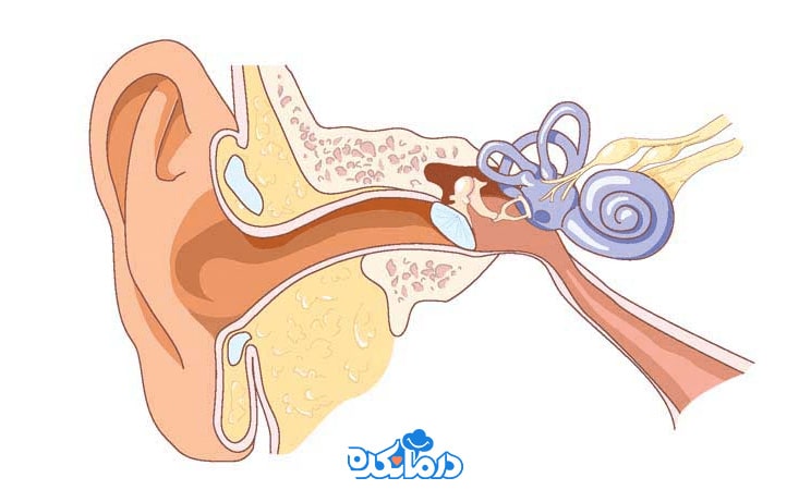 تصویر گرافیکی از گوش دارای عفونت