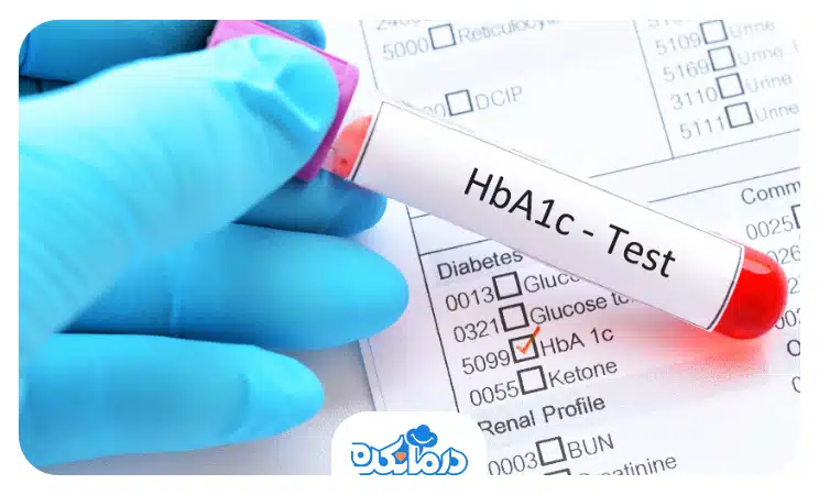  برگه آزمایشی که در آن نتیجه آزمایش قند خون HbA1c را می‌بینید.