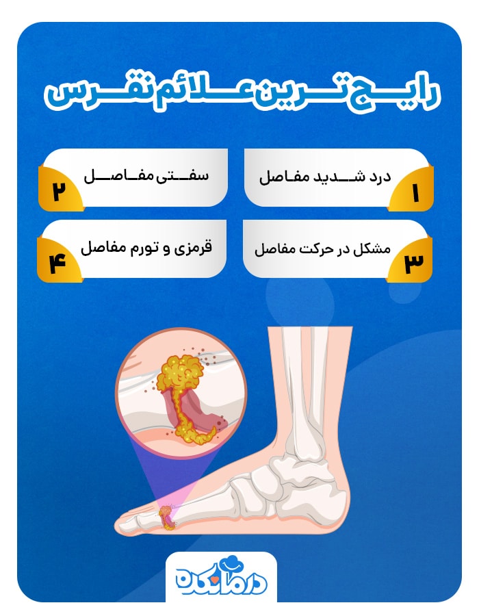 اینفوگرافی رایج ترین علائم نقرس