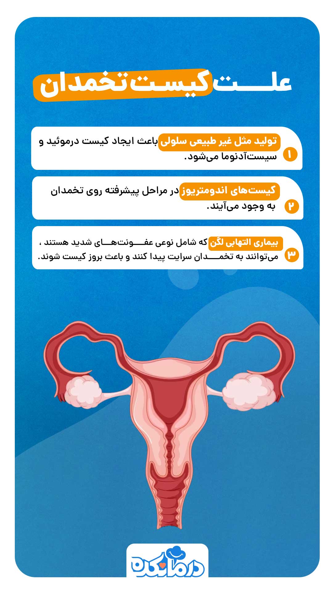 اینفوگرافی از علت کیست تخمدان