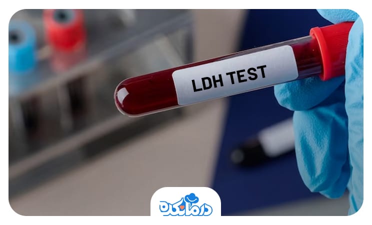 تصویر لوله آزمایشگاهی با برچسب تست LDH