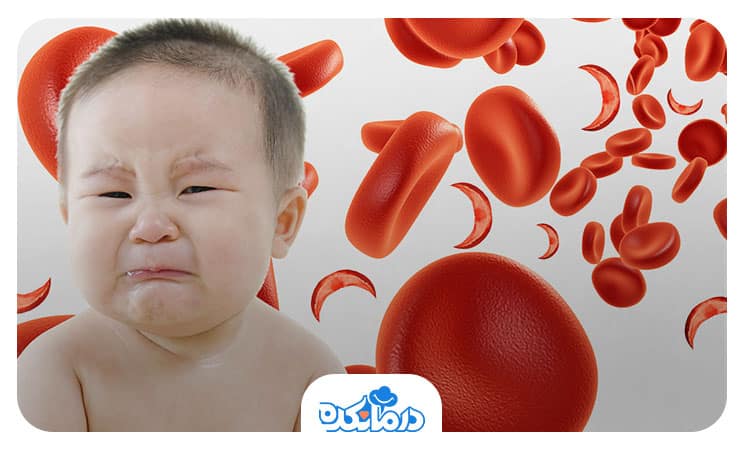 کودکی که گریه می‌کند و در پشت سر او گلبول‌های قرمز طبیعی یا داسی شکل دیده می‌شوند