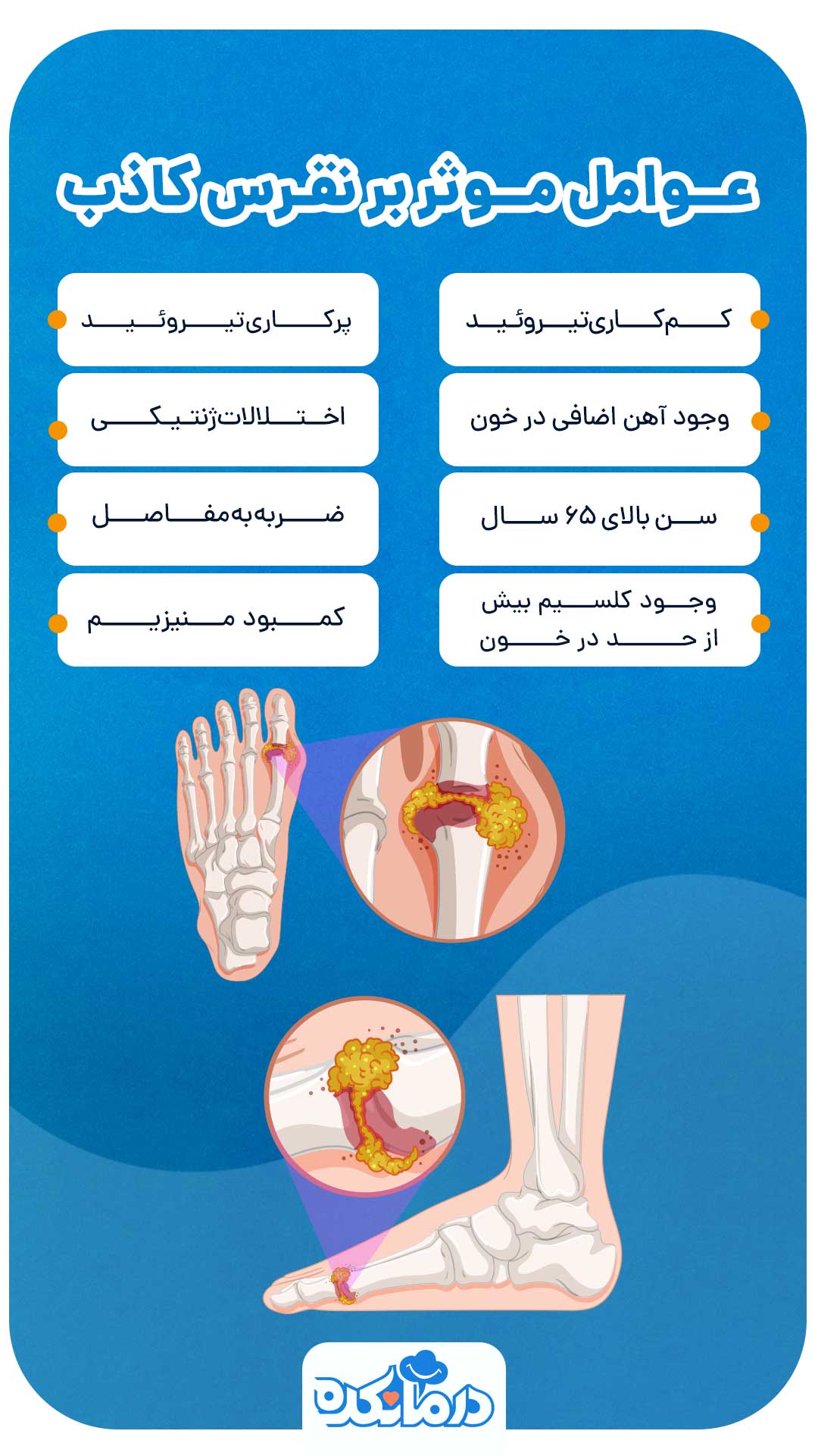 اینفوگرافی عوامل موثر بر نقرس کاذب