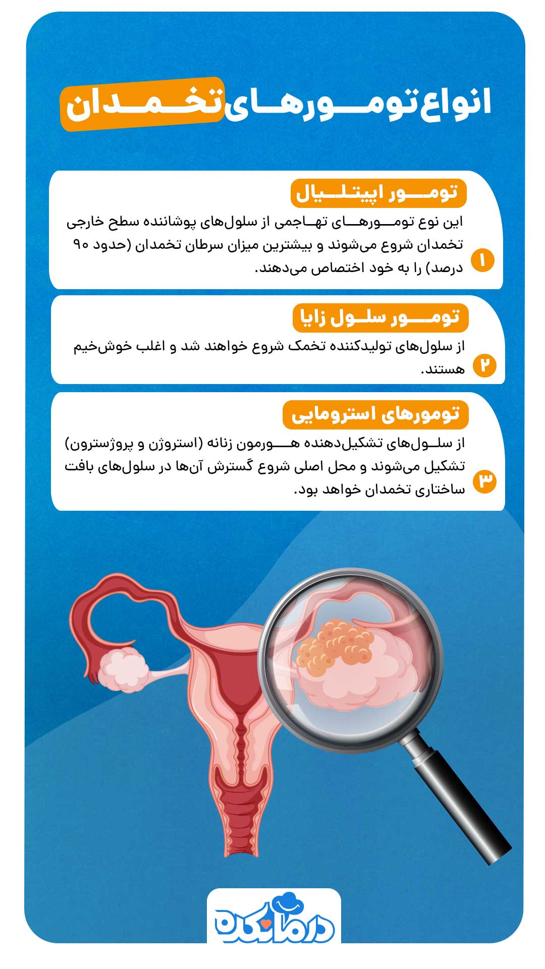 اینفوگرافی انواع تومور تخمدان