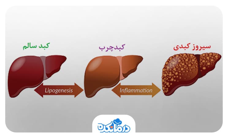 تصویری از فرآیند آسیب به کبد