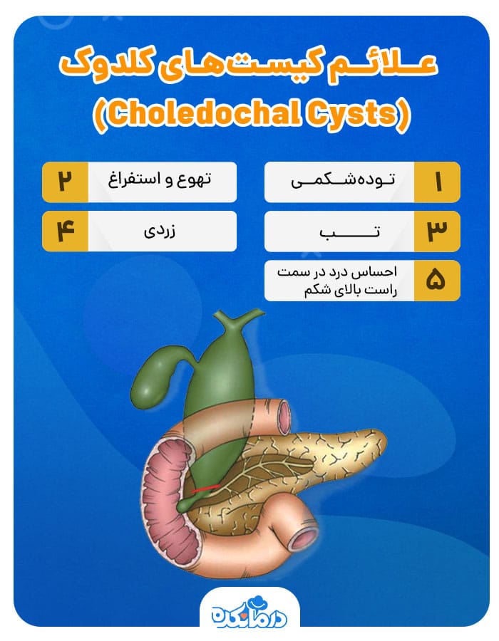اینفوگرافی علائم کیست‌های کلدوک (Choledochal Cysts)