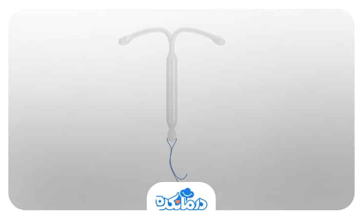 تصویر دستگاه IUD با نخ آن
