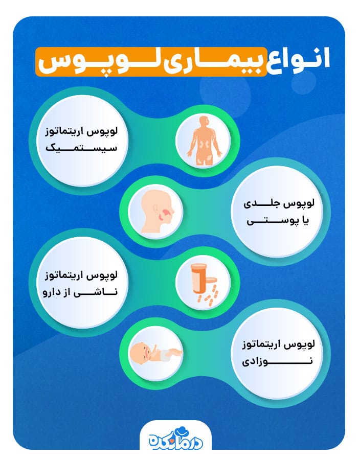 اینفوگرافی انواع لوپوس