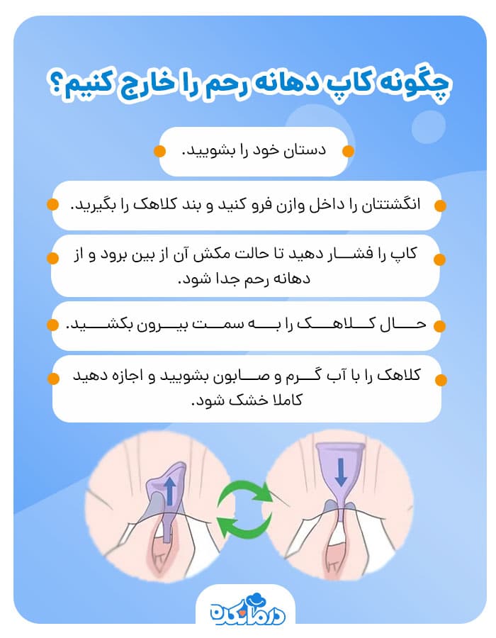 اینفوگرافی خارج کردن کلاهک دهانه رحم