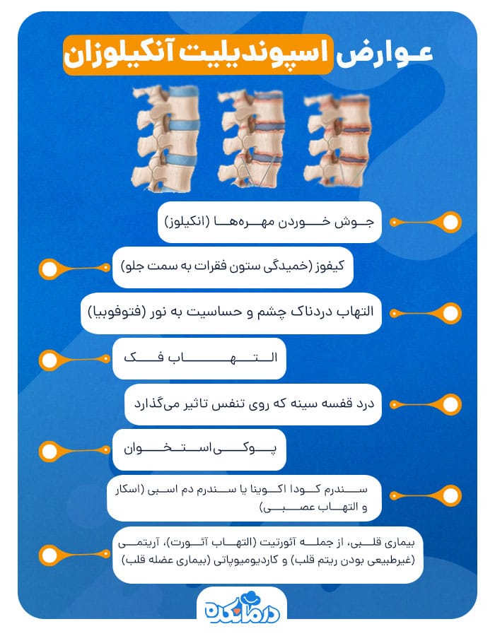 اینفوگرافی درباره عوارض اسپوندیلیت آنکیلوزان