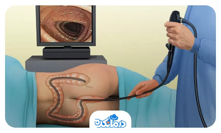 تصویر دستگاه سیگموئیدوسکوپی (Sigmoidoscopy)