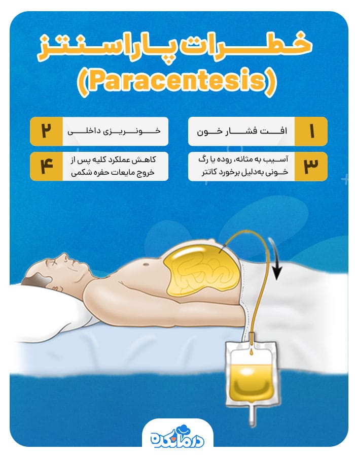 اینفوگرافی خطرات پاراسنتز (Paracentesis)