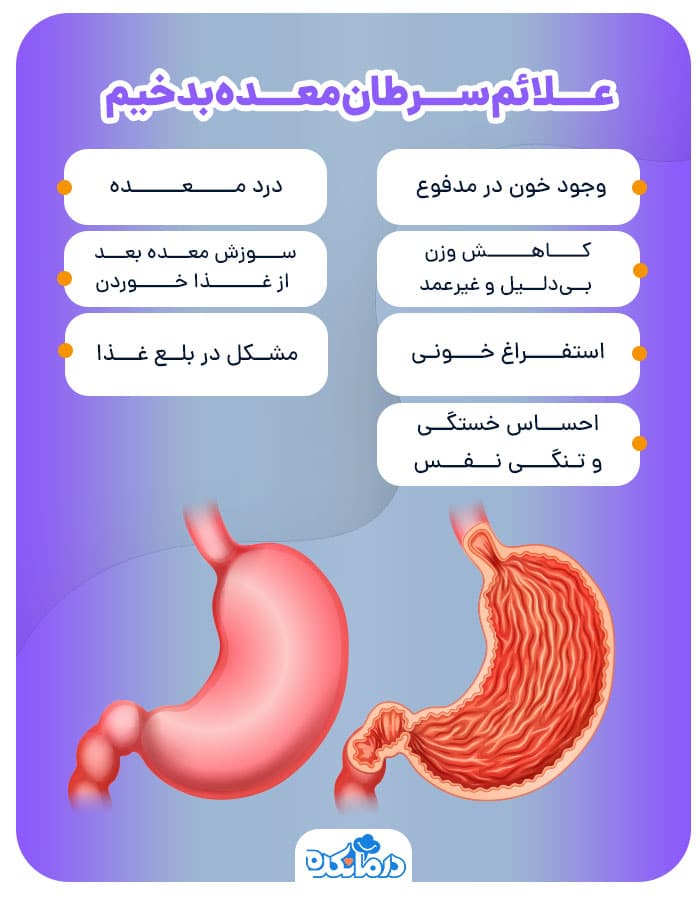 اینفوگرافی سرطان معده بدخیم