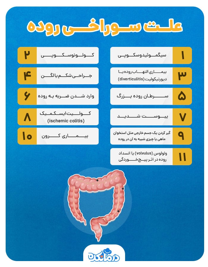 اینفوگرافی علت سوراخی روده