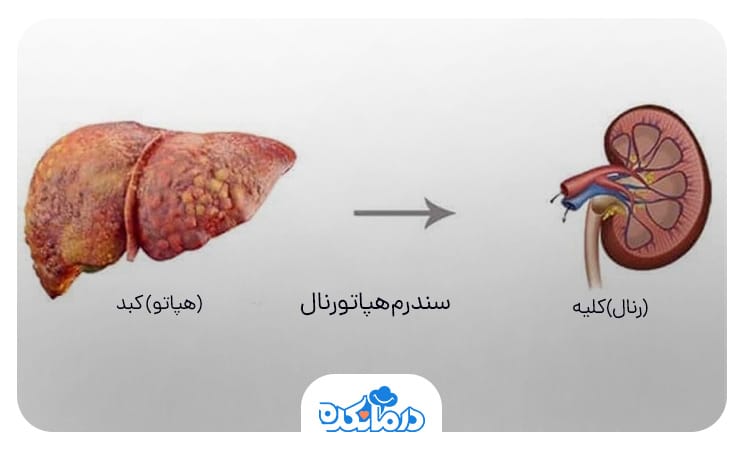 تصویری از یک کبد مبتلا به بیماری مزمن و یک کلیه