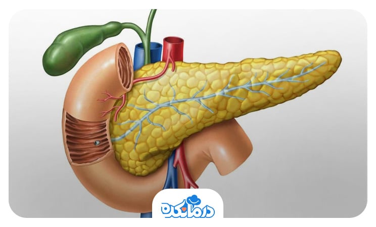تصویری از پانکراس مبتلا به نکروز