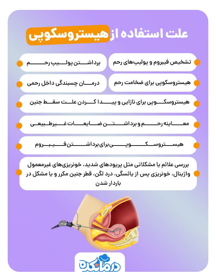 اینفوگرافی علت استفاده از هیستروسکوپی