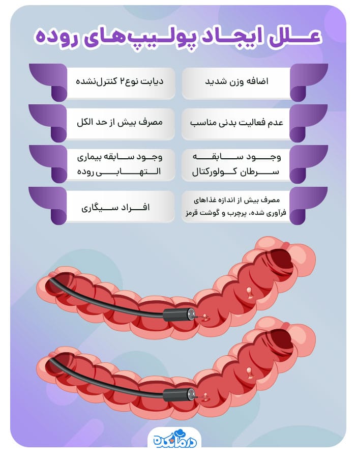 اینفوگرافیگ علت ایجاد پولیپ روده