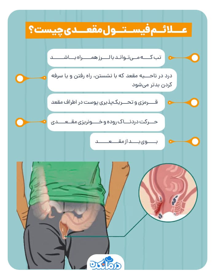 اینفوگرافیکی از علائم فیستول مقعدی