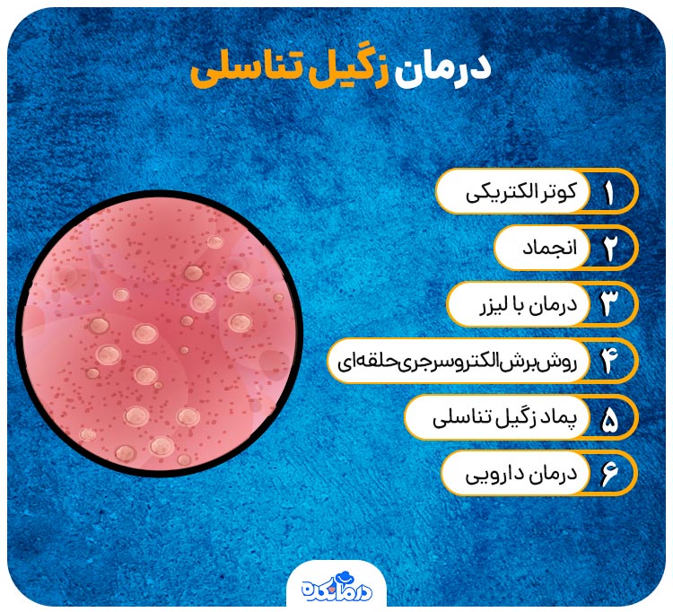 اینفوگرافیک درمان زگیل تناسلی