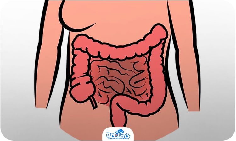 تصویر شماتیک از بدن و روده‌های داخل آن