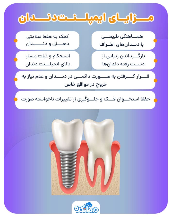 اینفوگرافیک مزایای ایمپلنت‌دندان