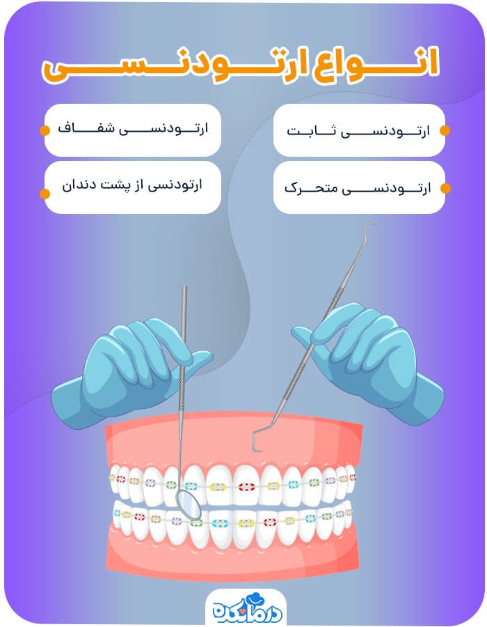 اینفوگرافی انواع ارتودنسی