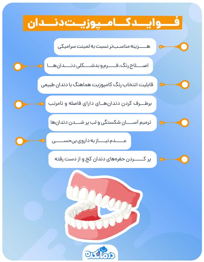 اینفوگرافیک فواید کامپوزیت‌دندان