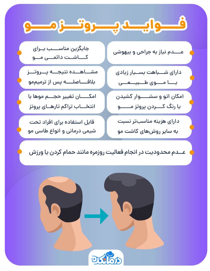 اینفوگرافیک فواید پروتز مو