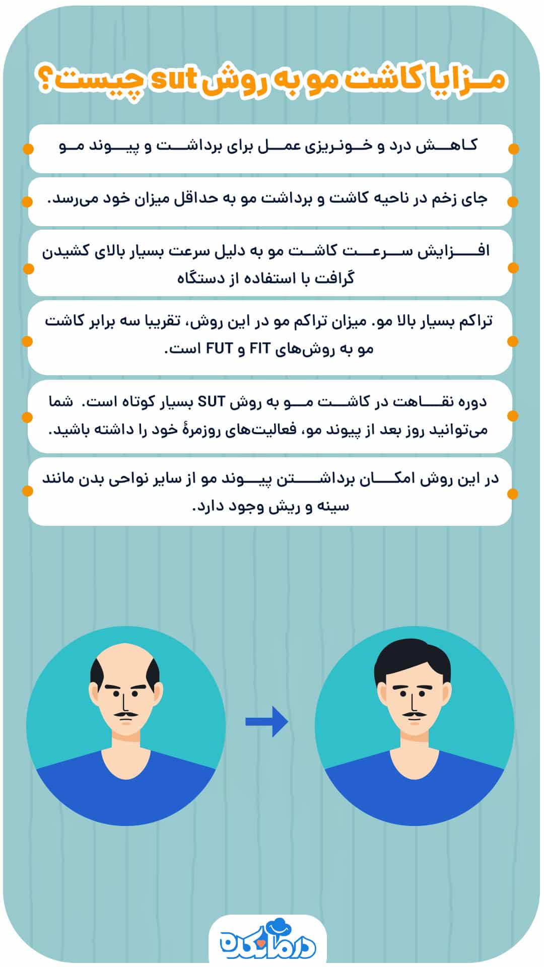 اینفوگرافیکی که مزایای کاشت مو به روش sut را نشان می‌دهد.