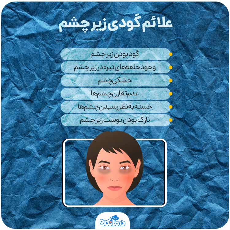 اینفوگرافی درباره علائم گودی زیر چشم