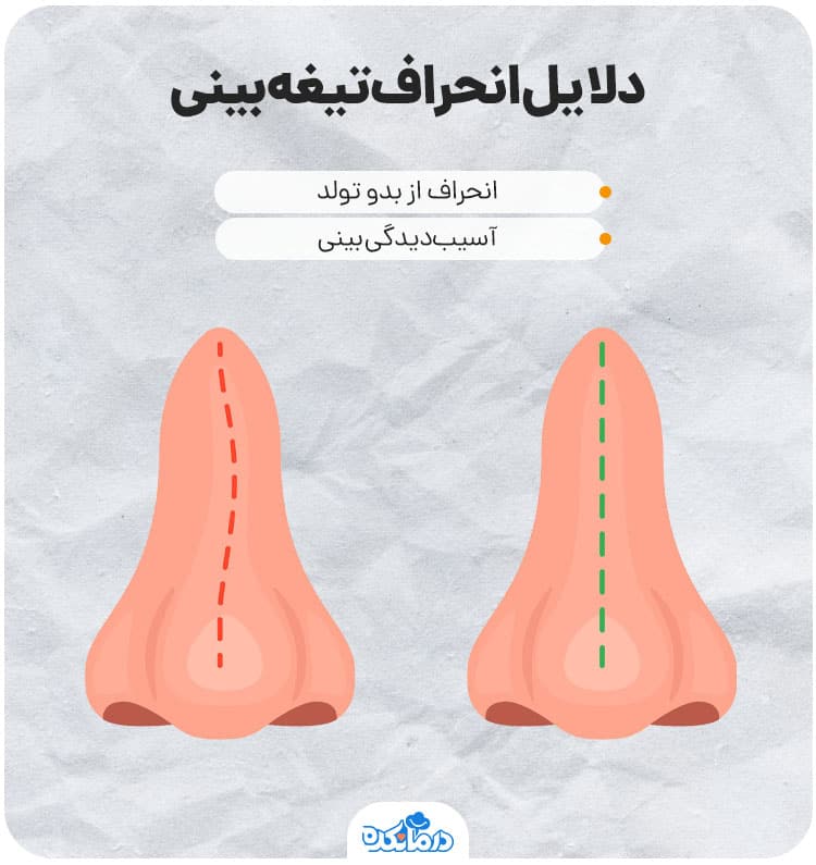 اینفوگرافی درباره دلایل انحراف بینی