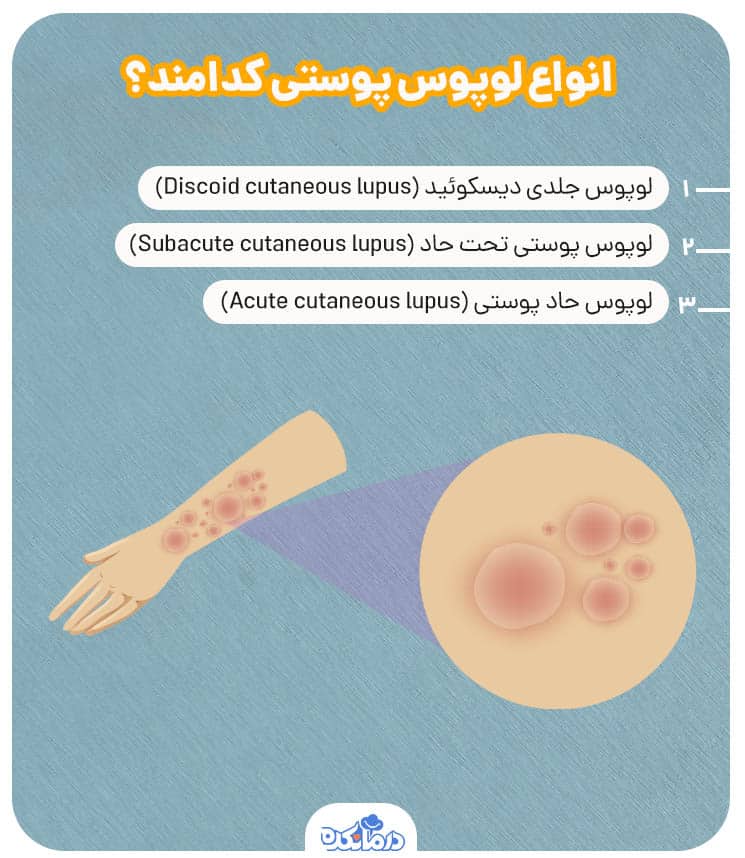 اینفوگرافیک انواع لوپوس پوستی