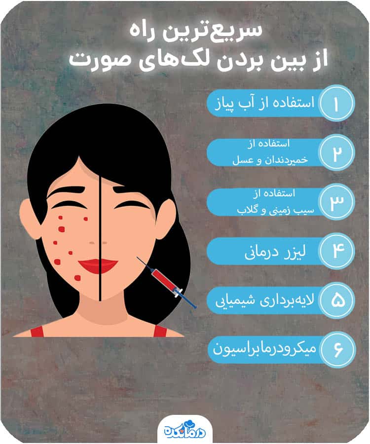 اینفوگرافیک سریع‌ترین راه از بین بردن و درمان لک‌های صورت