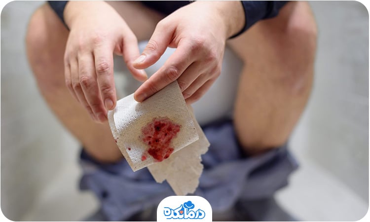 فردی که روی توالت فرنگی نشسته و در حال اجابت مزاج است. او دستمال توالت خونی در دست دارد. خون در اسهال از علائم خونریزی دستگاه گوارش است.