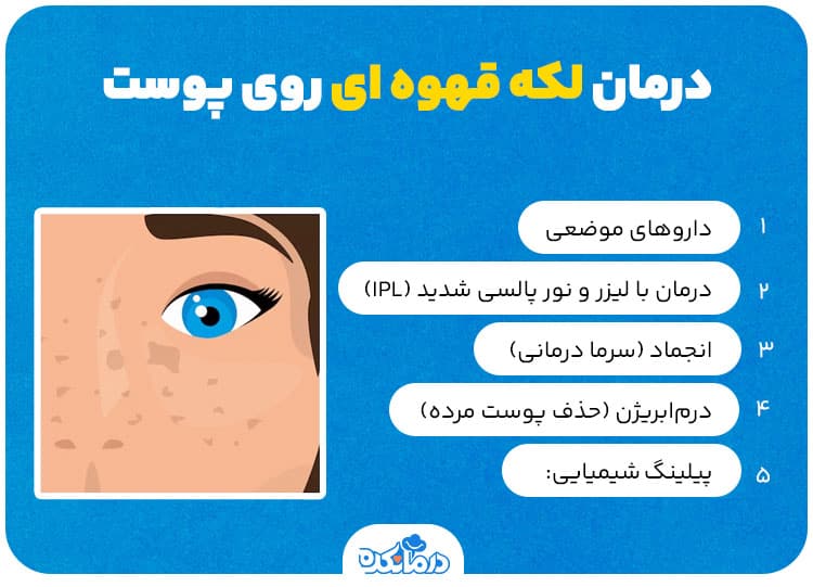 اینفوگرافی درباره راه‌های درمان لکه قهوه ای روی پوست