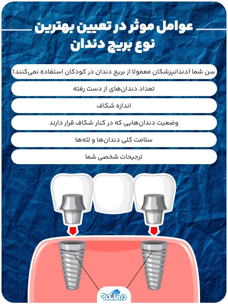 اینفوگرافی درباره عوامل موثر در انتخاب بهترین بریج دندان