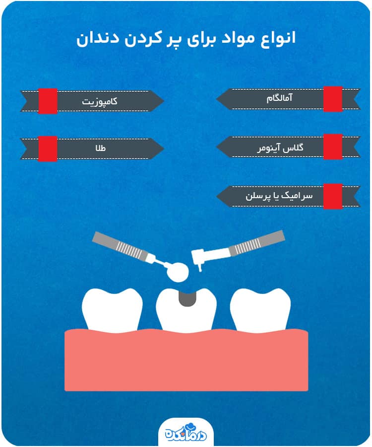 اینفوگرافی درباره انواع مواد برای پر کردن دندان