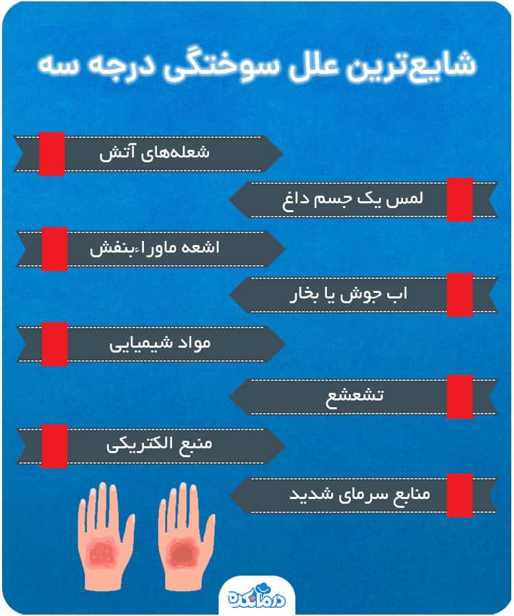 اینفوگرافیک شایع‌ترین علل سوختگی درجه سه