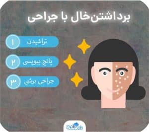 برداشتن خال چگونه است؟ انواع درمان، عوارض + بهترین پماد