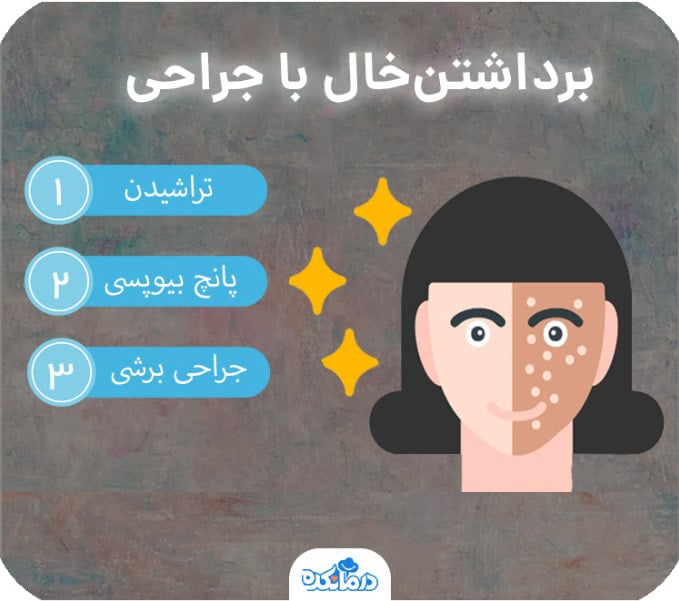 اینفوگرافیک رو‌ش‌های برداشتن‌خال با جراحی