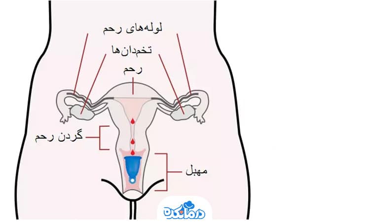 تصویری از سایز مختلف کاپ قاعدگی درون دهانه رحم با ارتفاع پایین و بالا