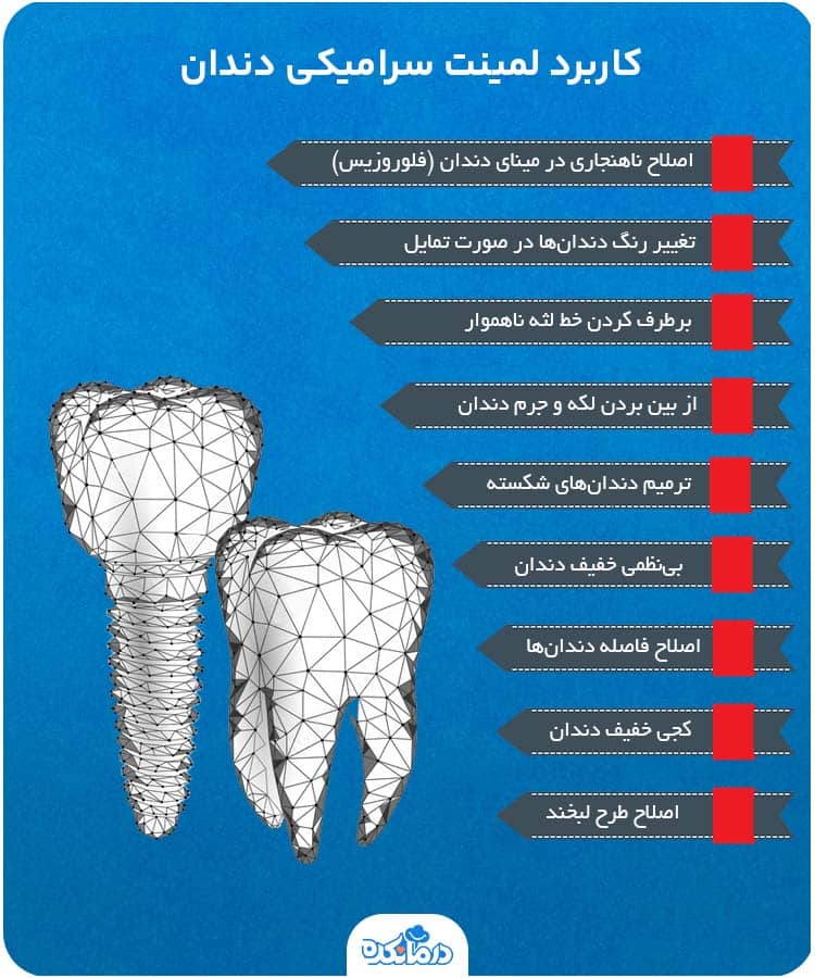 اینفوگرافیک کاربرد لمینت سرامیکی دندان