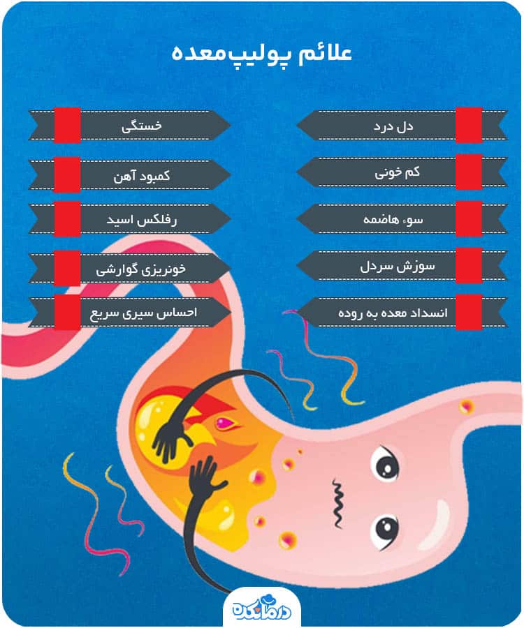 اینفوگرافیک علائم پولیپ‌معده