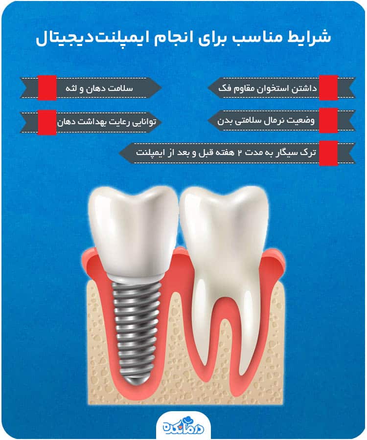 اینفوگرافیک شرایط مناسب برای انجام ایمپلنت‌دیجیتال