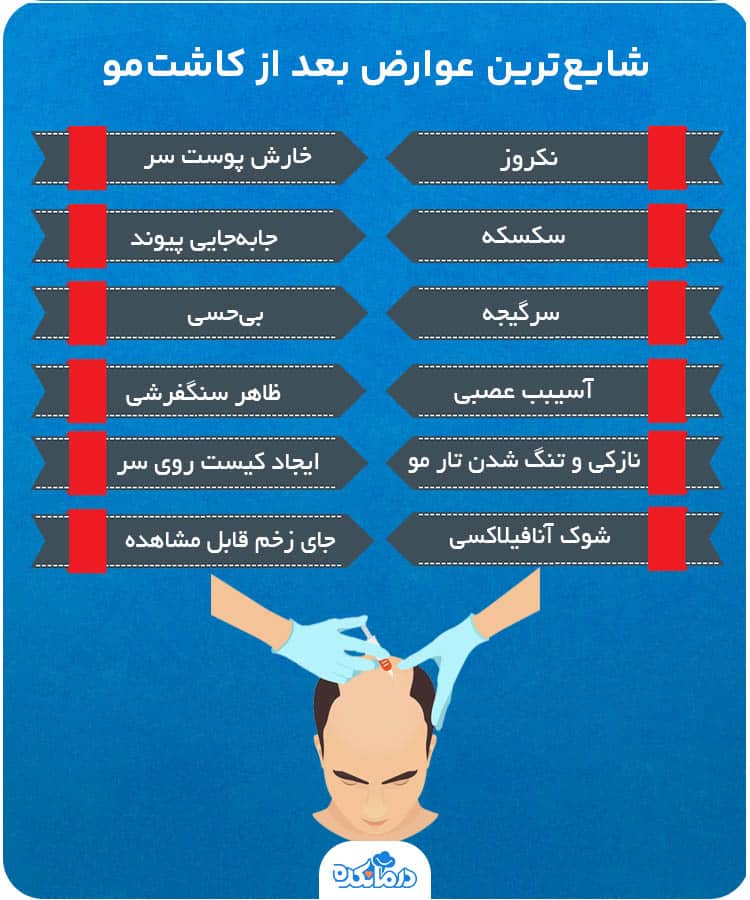 اینفوگرافیک شایع‌ترین عوارض بعد از کاشت‌مو