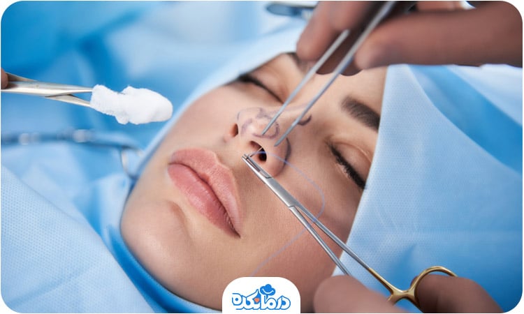 تصویری از فرآیند انجام جراحی بسته بینی