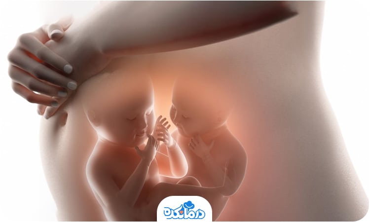 تصویر جنین دوقلو در شکم مادر در هفته ۲۵ بارداری