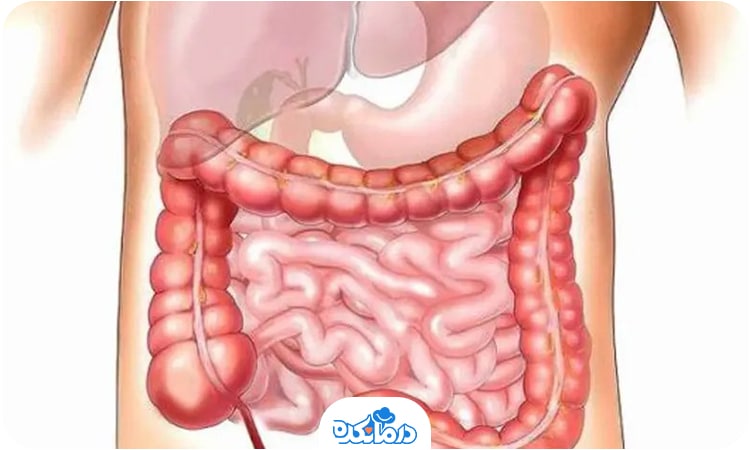 تصویر دستگاه گوارش شامل روده کوچک و بزرگ