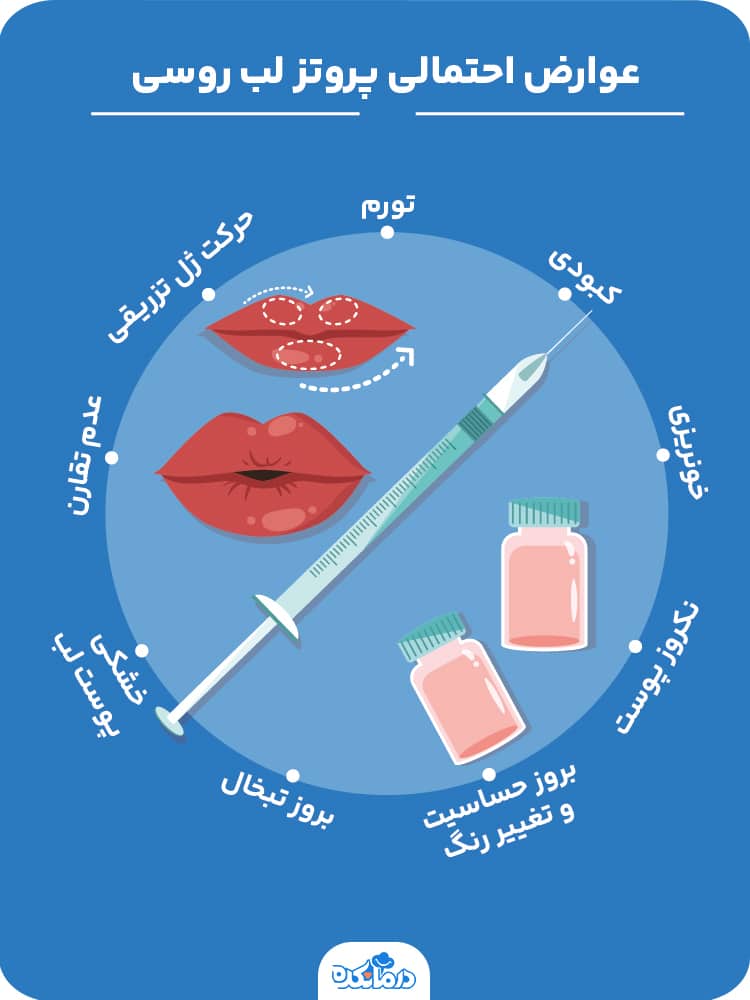 اینفوگرافیک عوارض احتمالی پروتز لب روسی